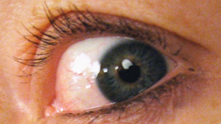 Nahaufnahme eines Auges