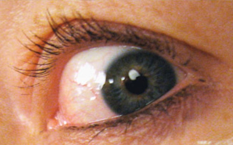 Auge Nahaufnahme eines Auges