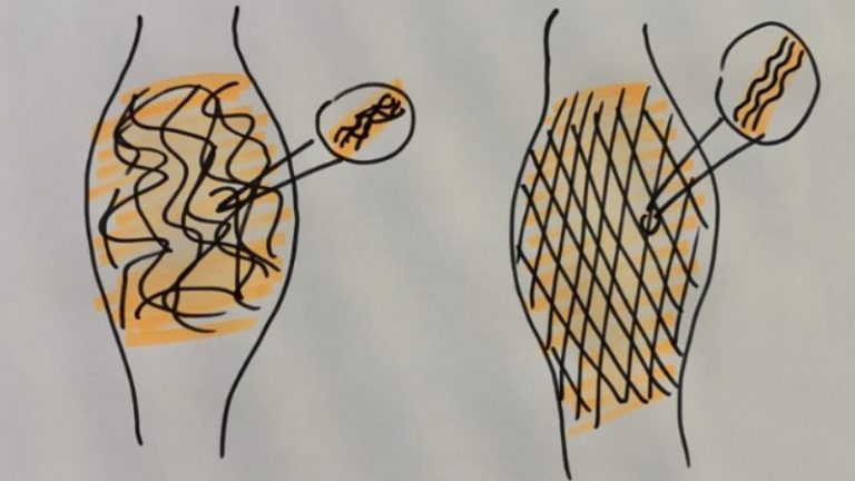 Eine Skizze von Faszien im Querschnitt um das Faszientraining aus chiropraktischer Sicht zu veranschaulichen